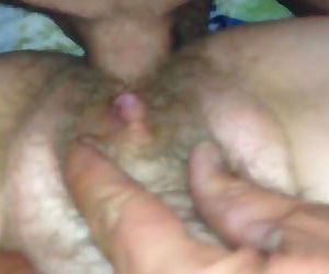 Hairy 63 year old